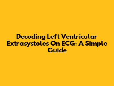 Decoding Left Ventricular Extrasystoles On ECG: A Simple Guide