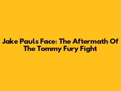 Jake Paul's Face: The Aftermath Of The Tommy Fury Fight